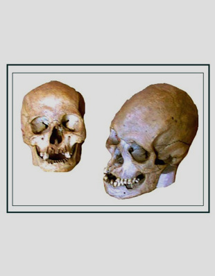 HUMAN SKULLS